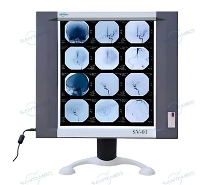 Led Ray Film Viewer
